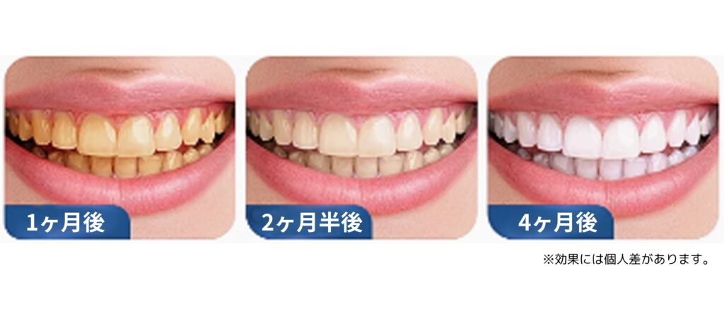 画像に alt 属性が指定されていません。ファイル名: %E6%AD%AF700-1-3-1024x458.jpg